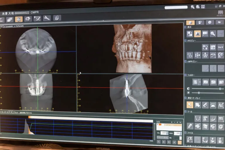 デジタルシステム